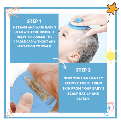 Baby Comb and Brush for Cradle Cap - Gummia